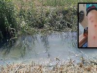 Deredeki mikrop insanlara bulaşıyor