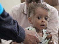 UNICEF Yemen'e 6 milyon doz aşı yardımında bulundu
