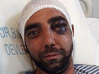 Polis’te darp iddiası!