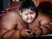 Arya Premana dünyanın en şişman çocuğuydu! Bakın şimdi kaç kilo...