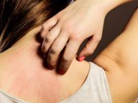 Kaşıntı hissi neden oluşur, kaşınmalı mıyız?