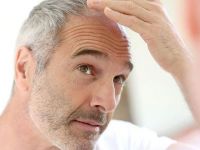 Saçkıran (Alopesi areata) nedir?