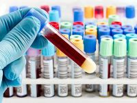 Sağlığımız tehdit altında!