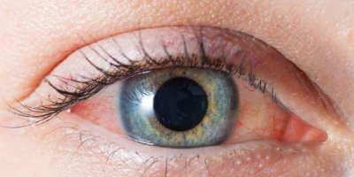 “Sinsi hastalık glokom, erken tanıyla önlenebilir"