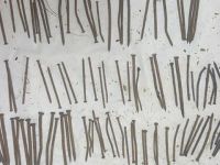 Etiyopyalı hastanın midesinden 120 adet çivi çıktı