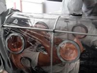 ABD'deki virüs salgınında 6 çocuk hayatını kaybetti