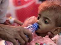 Yemen'de 85 bin çocuk hayatını kaybetti