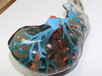 Karaciğer naklinde 3D dönemi