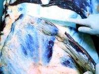 Fransa'da "Veremli et" iddiası