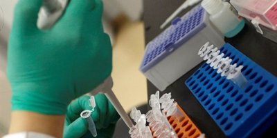 Meme kanserini tespit eden kan testi