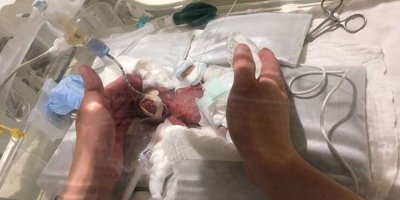 Dünyanın en küçük erkek bebeği taburcu edildi