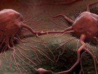 Irak'taki kanser vakalarında artış