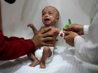 "Doğu Guta'da yetersiz beslenen çocukların sayısı ürkütücü boyutlarda"