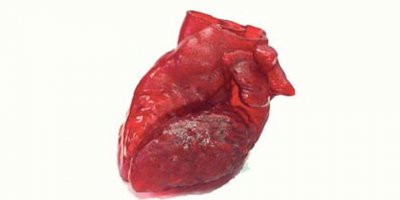 Organ ihtiyacında çığır açacak bir yenilik