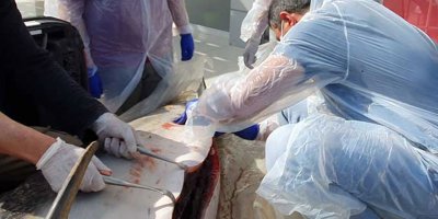 Midesinden plastik ağ çıktı