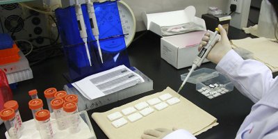 Gen teknolojisiyle HIV virüsü tarih olabilir: Hayvanlar üzerinde başarılı oldu