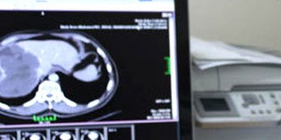 Ekinokok Hastalığı hayvanlardan insanlara bulaşıyor