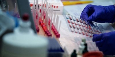 Rus milletvekillerinden gen değiştirme araştırmaları yapılması talimatı