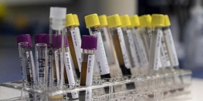 Genetik hastalıkların tedavisi artık mümkün olabilir!