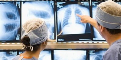 Pulmoner hipertansiyon (KTEPH) nasıl tedavi edilir?