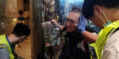 Siyasetçinin kulağını ısırdılar