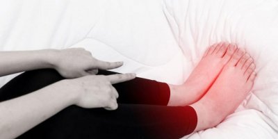 Ödem nasıl geçer?