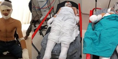 Acemi kundakçılar kendilerini yaktı