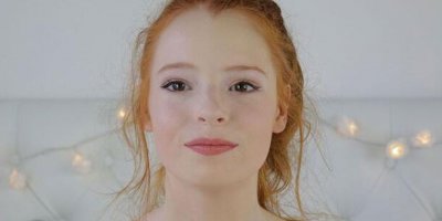 Lise çağında dudak dolgusundan uzak durulmalı