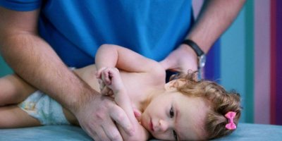 Serebral palsi bebeklerde nasıl anlaşılır?