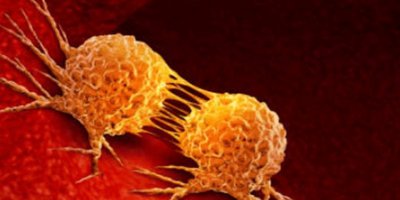 Akciğer kanserini erken evrede tespit etmek için ne yapmak gerekir?