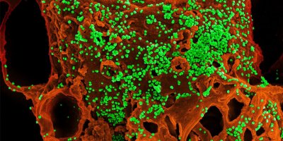 Gizemli virüs'ten etkilenenlerin sayısı  140'a çıktı