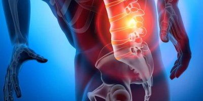 Bel fıtığı ameliyatsız yöntemlerle tedavi edilebiliyor