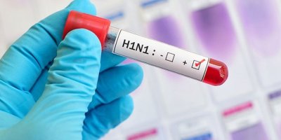 Ordu’daki ölümün domuz gribinden olduğu kesinleşti