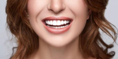 Dişleri beyazlatan yiyecekler nelerdir?