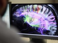 Beynin elektrik bağlantılarının haritası çıkarıldı