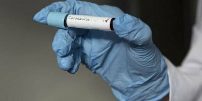 Koronavirüste ilk 400 vaka verileri