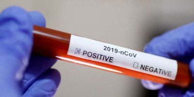 İran Sağlık Bakanı Yardımcısı koronavirüse yakalandı