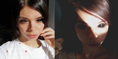Polonya'da gözünün içini siyaha boyatan kadın görme yetisini kaybetti