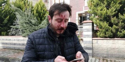 Komşuların gürültü kavgası kanlı bitti: 3 yaralı