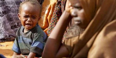 Nijerya'da 2 bin 753 kişiye bir doktor düşüyor