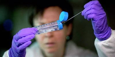 Rus bilim insanları farelerde kanser türlerinden birini tedavi etmeyi başardı