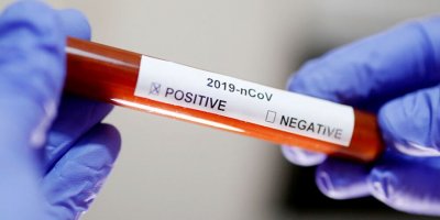 Güney Kıbrıs’ta vaka sayısı 715’e ulaştı