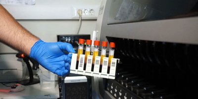 İstanbul Tıp Fakültesi'nde antikor testi yapılmaya başlandı