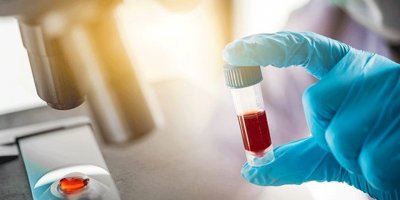 İstanbul Tıp Fakültesi Dekanı açıkladı: Antikor testi pozitif olan hasta sayısı çok az