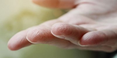 Salgın döneminde kuruyan ciltler için düzenli nemlendirici kullanılması önerisi