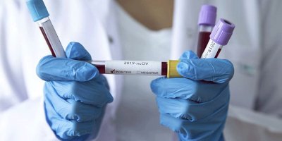 Güney Kıbrıs’ta lise öğrencisi’nin korona testi pozitif