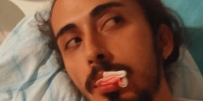 Akılalmaz olay! 'Bana da bir şarkı çal' diyerek yaklaştılar çenesini kırdılar