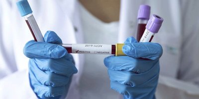 Girne Belediyesi’nde vaka