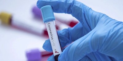 Dünyada kovid-19 vaka sayısı 53 milyonu geçti