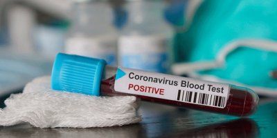 Güney Kıbrıs’ta bölgesel karantina uygulamada